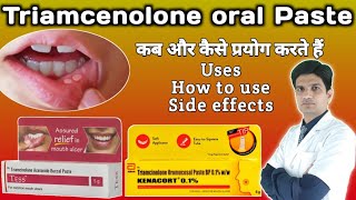 Kenacort 01  Kenacort gel how to use  Triamcinolone oromucosal paste bp 01 ww [upl. by Nitsruk]