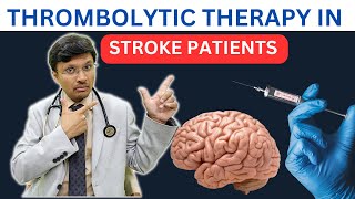 THROMBOLYTIC THERAPY IN STROKE PATIENTS [upl. by Genni]