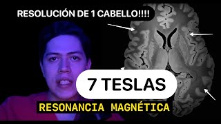 Resonancia Magnética de 7 Teslas La Revolución en Imágenes Médicas [upl. by Barvick]