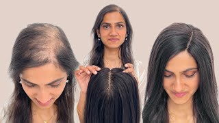 Crown Lace Topper  Hairstyles Using Human Hair Topper  Hair Topper For Hair Thinning [upl. by Abrahan]