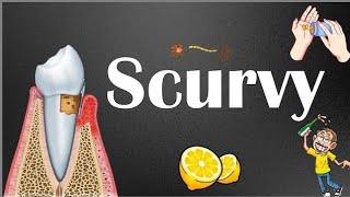 Scurvy Is Back [upl. by Trub]