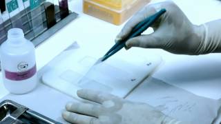 DNA Fragmentation Test Procedure  Sperm360 [upl. by Jews734]