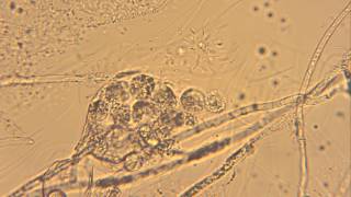 Releasing Oospores from Oogonium Oomycetes [upl. by Wall]