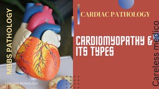 CARDIAC PATHOLOGY Cardiomyopathy amp its typeslecture18mbbs pathology pathoma robbins cvs [upl. by Attennyl631]