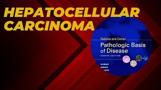 Hepatocellular carcinoma  Risk factors  Pathogenesis  Morphology  Clinical features [upl. by Eisnil404]