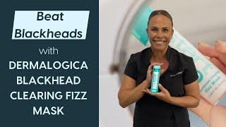 Beat Blackheads With Dermalogicas Blackhead Clearing Fizz Mask [upl. by Fabrianne]