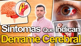 Ojo Con Estos Síntomas  Síntomas De Derrame Cerebral Y Cómo Prevenirlo Naturalmente [upl. by Troc]