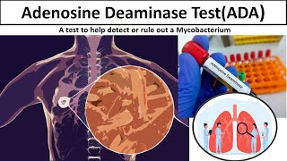 Adenosine Deaminase Test  Clear overview Tuberculosis ADAtestADAmlsmedilabacademy [upl. by Jonah]