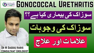 Gonorrhea Gonorrhea Treatment  Gonorrhea Meaning  SOZAK  سوزاک کیا ہے؟  سوزاک کا علاج [upl. by Ymij]