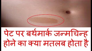 पेट पर बर्थमार्क होने का क्या मतलब होता है  Birthmark on stomach and its meaning pet par janmchinh [upl. by Hoebart]