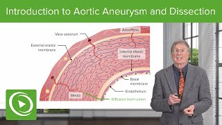 Introduction to Aortic Aneurysm and Dissection [upl. by Thalassa]