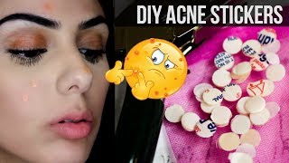 bandaids for acne  THE BEST OVERNIGHT PIMPLE SPOT TREATMENT HANDS DOWN  DIY [upl. by Naniac917]