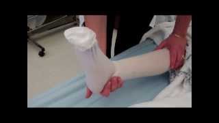 CNA Essential Skills  Apply One KneeHigh Elastic Stocking 413 [upl. by Burley790]