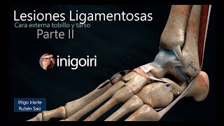 US EN LESIONES LIGAMENTOS EXTERNOS DEL TOBILLO PARTE II [upl. by Nelrsa856]