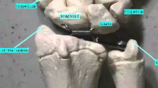 Carpal and Metacarpal bones [upl. by Eidas]