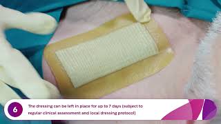 How to Apply and Remove Aquacel® Ag Surgical Dressings Pacemaker [upl. by Anitnas459]