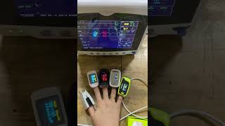 Comparison of pulse oximeter [upl. by Neelrak]