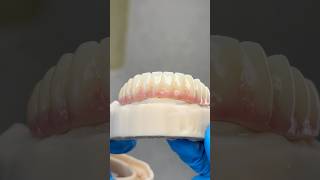 Lower PMMA Provisional EnvisiontecMain envisiontec lsk121shorts dentist teethsmile [upl. by Latrice]