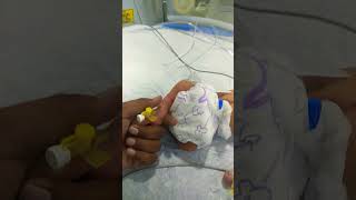 How to insert cannula in newborn baby ventilator newborncare criticalbaby [upl. by Hgielsa]