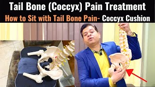 Tailbone Pain Relief Treatment Coccydynia Coccyx Seat Cushion Tail bone Exercises Sitting Pain [upl. by Corkhill]