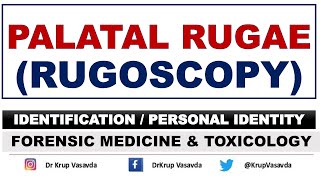 Rugoscopy  Palatal Rugae  Identification  Dr Krup Vasavda [upl. by Alcott]