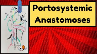 Portosystemic Anastomoses [upl. by Julianne]