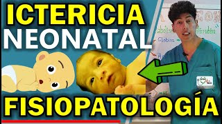 ICTERICIA NEONATAL FISIOPATOLOGÍA  GuiaMed [upl. by Oralie994]