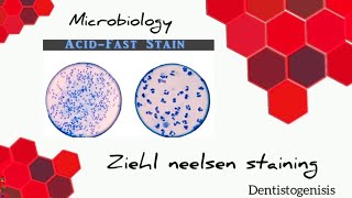 Ziehl Neelsen staining  Acid Fast staining microbiology 2ndyear BDS [upl. by Arhas390]