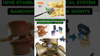 HIVE Standalone Cervical System NanoHive Medical  4K Video medical animation 3d short [upl. by Jurkoic795]