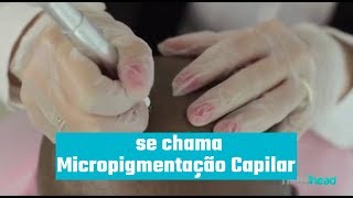 O que é Micropigmentação Capilar [upl. by Granlund]