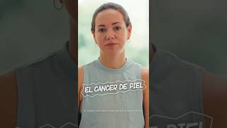 LaLesiónMásPeligrosa el Cáncer de Piel  Testimonio de Giuliana Nagaro [upl. by Whitebook]