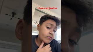 Jawless kid hahahahah🥶 [upl. by Nav]