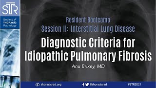 Diagnostic Criteria for Idiopathic Pulmonary Fibrosis [upl. by Akcinahs593]