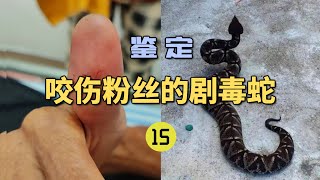 4K  鉴定咬伤粉丝的毒蛇（15）粉丝的父亲被五步蛇咬伤！出现严重凝血异常？指标都测不出来了！【世界记忆大师龙雅】 [upl. by Euhsoj]