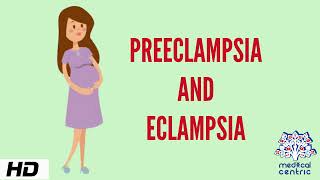 Preeclampsia and Eclampsia Causes Signs and Symptoms Diagnosis and Treatment [upl. by Eeralav]