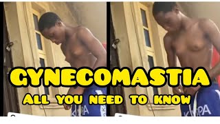 ALL YOU NEED TO KNOW ABOUT GYNECOMASTIA ytaids [upl. by Noedig]