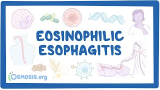 Eosinophilic esophagitis NORD [upl. by Nnylahs]