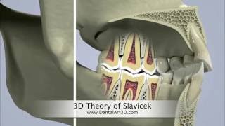 DentalArt3D 3D Theory of Slavicek [upl. by Enirok]