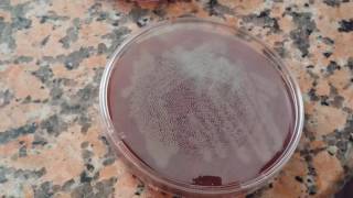 Bacillus subtilis on the blood agar [upl. by Behka529]