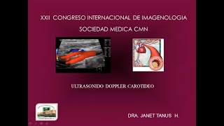 11  Ultrasonido doppler carotideo  Dra Tanus [upl. by Brigid]