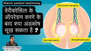 वेरीकोसिल के ऑपरेशन करने के बाद क्या अंडकोष सूख सकता है [upl. by Guenevere]