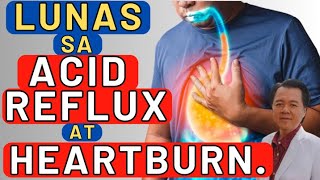 Lunas sa Acid Reflux at Heartburn  By Doc Willie Ong Internist and Cardiologist [upl. by Ardnuahs]