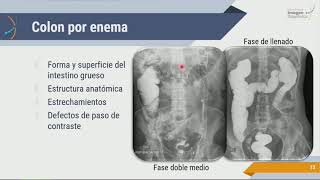 Radiología de Abdomen Estudios Contrastados [upl. by Eseilana]