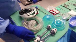 BASIC SET UP LAP CHOLECYSTECTOMY [upl. by Sardse]