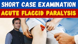 Acute flaccid paralysis case examination and presentation in paediatrics  AFPGBSPolioTMCIDP [upl. by Nylesoj781]