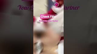 How to fill and get healthy cheeks skincare cheekfiller fillers trendingshorts viralvideo l [upl. by Hanoy]