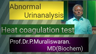 Heat Coagulation Test  Muralis Simplified Biochemistry [upl. by Yann]