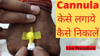 Cannula Kaise Lagate Hain  Kaise Nikale  Cannula Insertion Technique  Cannula Types  Hindi [upl. by Isidro448]