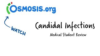 Candidal Infections Osmosis Study Video [upl. by Gereron]