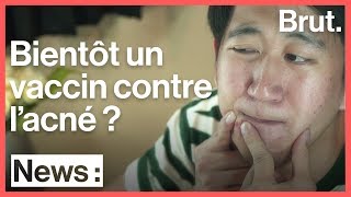 Bientôt un vaccin contre lacné [upl. by Zink803]